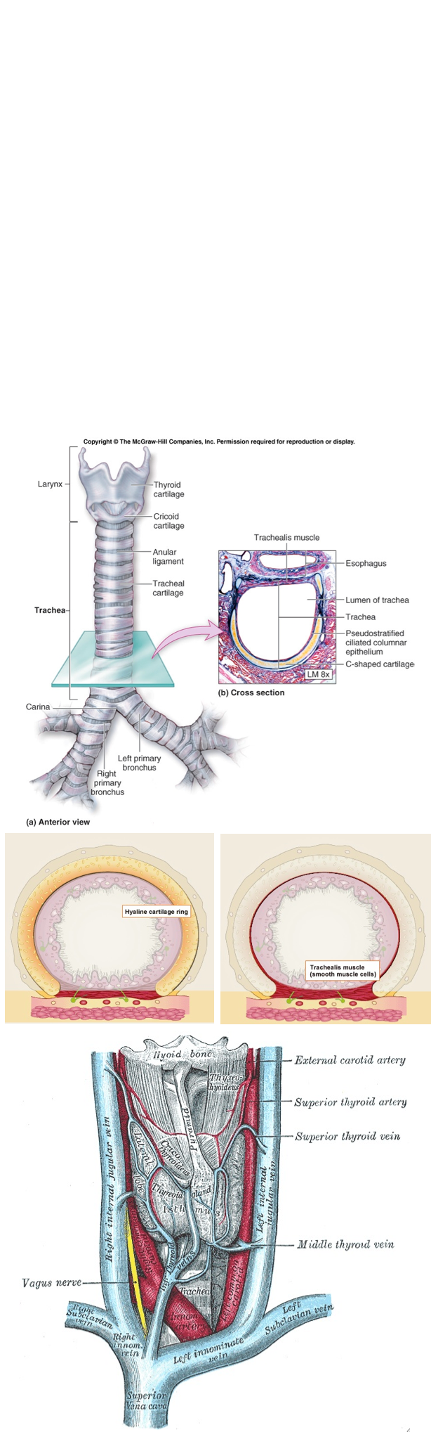 Anatomy
	หลอดลม(trachea)  วางตัวอยู่ในแนวmidline ของคอ  โดยอยู่ต่ำกว่าcricoid cartilage  ทางด้านบนที่ระดับ C6 ลงมายังsternal notch แล้วอยู่หลังต่อsternum และสิ้นสุดที่tracheal bifurcation ที่ระดับ sternal angle (T5)(4)    ประกอบด้วยกระดูกอ่อน(cartilage) tracheal ring รูป C-shape ไม่ครบวงทางด้านหลัง  เรียงต่อกันโดยมีfibrous tissue กั้นระหว่างกระดูกอ่อนแต่ละชิ้น  ทางด้านหลังของหลอดลมมีtrachealis muscle เชื่อมระหว่างกระดูกอ่อนรูป C-shape  ทำให้หลอดลมมีลักษณะครบวง  ภายในหลอดลมบุด้วย respiratory ciliated epithelium ส่วนภายนอกถูกห่อหุ้มด้วย pre-tracheal fascia  ขนาดของหลอดลมในผู้ใหญ่ยาวประมาณ12เซนติเมตร  และมีขนาดเส้นผ่านศูนย์กลาง 15-20 มิลลิเมตร  ซึ่งขนาดจะเล็กลงในผู้หญิงและเด็ก  ความยาวของหลอดลมในบริเวณคอ(cervical length) สามารถเพิ่มได้โดยการแหงนศีรษะและคอ
	บริเวณtracheal ring  ที่ 2-4 มีthyroid isthmusอยู่ทางด้านหน้า จากนั้นมี strap muscles,deep and superficial fascia, anterior jugular vein, platysma muscle,subcutaneous tissue และ ผิวหนังอยู่บนสุด เรียงตามลำดับ    ทางด้านข้างของหลอดลมมี Recurrent laryngeal nerve (RLN)อยู่ในtracheoesophageal groove, common carotid artery และ internal jugular vein  ทางด้านข้าง    ส่วนทางด้านหลังของหลอดลมมี หลอดอาหาร(esophagus), prevertebral fascia และกระดูกสันหลัง   ทางด้านล่างมีbracheocephalic veinวิ่งผ่านหลอดลมทางด้านหน้าในแนวเฉียง โดยมีinominate artery วิ่งผ่านด้วย ซึ่งต้องระวังในกรณีที่ dissect ลงด้านล่างมากๆ นอกจากนี้ยังต้องระวังpleura ของปอดด้วย

           ￼
  ￼   ￼                                            
        ￼

                                                             