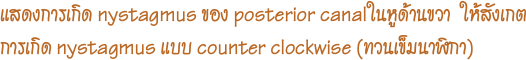 แสดงการเกิด nystagmus ของ posterior canalในหูด้านขวา  ให้สังเกตการเกิด nystagmus แบบ counter clockwise (ทวนเข็มนาฬิกา)