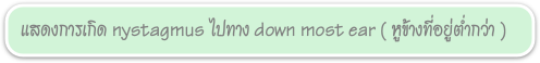 แสดงการเกิด nystagmus ไปทาง down most ear ( หูข้างที่อยู่ตำ่กว่า )